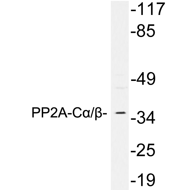 PP2A Alpha + Beta Antibody - Western blot analysis of lysates from A549 cells, using PP2A-CÎ±/Î² antibody.
