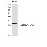 PP2Ac / PPP2CA Antibody - Western blot of Phospho-PP2A-Calpha (Y307) antibody