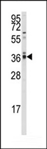 PP2Ac / PPP2CA Antibody - Western blot of anti-hPPP2CA/B Antibody in A2058 cell line lysates (35 ug/lane). PPP2CA/B (arrow) was detected using the purified antibody.