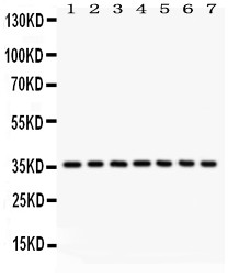 PP2Ac / PPP2CA Antibody - PP2A-alpha antibody Western blot. All lanes: Anti PP2A-alpha at 0.5 ug/ml. Lane 1: Rat Kidney Tissue Lysate at 50 ug. Lane 2: Mouse Kidney Tissue Lysate at 50 ug. Lane 3: Human Placenta Tissue Lysate at 50 ug. Lane 4: Rat Liver Tissue Lysate at 50 ug. Lane 5: NIH Whole Cell Lysate at 40 ug. Lane 6: PC-12 Whole Cell Lysate at 40 ug. Lane 7: 293T Whole Cell Lysate at 40 ug. Predicted band size: 36 kD. Observed band size: 36 kD.