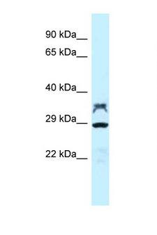 PP2Ac / PPP2CA Antibody - PPP2CA / PP2Ac antibody Western blot of Rat Brain lysate. Antibody concentration 1 ug/ml.  This image was taken for the unconjugated form of this product. Other forms have not been tested.