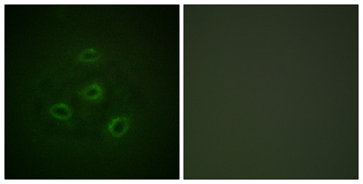 PP2Ac / PPP2CA Antibody - Immunofluorescence analysis of HepG2 cells, using PP2A-alpha Antibody. The picture on the right is blocked with the synthesized peptide.