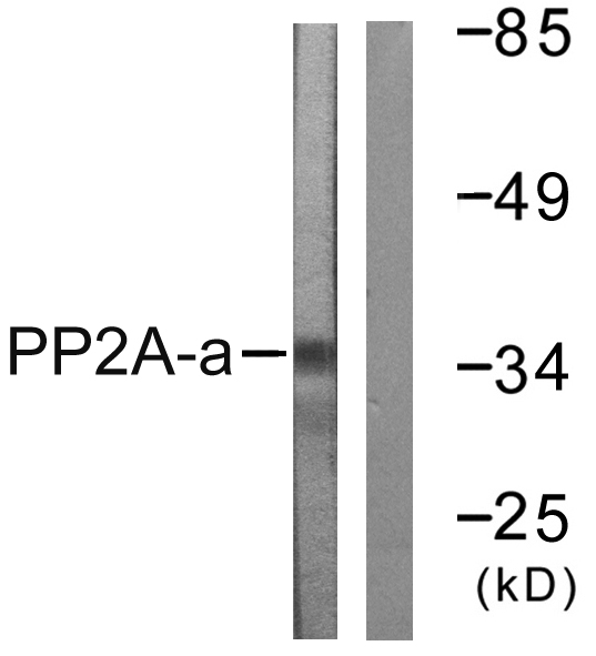 PP2Ac / PPP2CA Antibody - Western blot analysis of lysates from A549 cells, using PP2A-alpha Antibody. The lane on the right is blocked with the synthesized peptide.