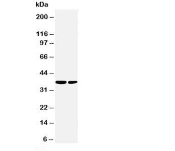 PP2Ac / PPP2CA Antibody - Western blot testing of PP2Ac antibody and Lane 1: rat kidney; 2: HeLa; Predicted size: 36KD; Observed size: 36KD