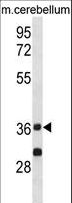 PP2Ac / PPP2CA Antibody - PPP2CA Antibody western blot of mouse cerebellum tissue lysates (35 ug/lane). The PPP2CA antibody detected the PPP2CA protein (arrow).