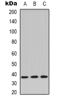 PP2Ac / PPP2CA Antibody - Western blot analysis of PPP2CA expression in Jurkat (A); L929 (B); A549 (C) whole cell lysates.