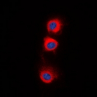 PP2Ac / PPP2CA Antibody - Immunofluorescent analysis of PPP2CA staining in HepG2 cells. Formalin-fixed cells were permeabilized with 0.1% Triton X-100 in TBS for 5-10 minutes and blocked with 3% BSA-PBS for 30 minutes at room temperature. Cells were probed with the primary antibody in 3% BSA-PBS and incubated overnight at 4 deg C in a humidified chamber. Cells were washed with PBST and incubated with a DyLight 594-conjugated secondary antibody (red) in PBS at room temperature in the dark. DAPI was used to stain the cell nuclei (blue).