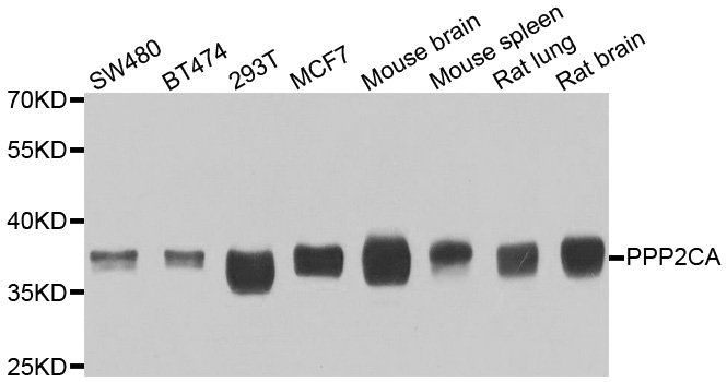 PP2Ac / PPP2CA Antibody - Western blot analysis of extracts of various cell lines.