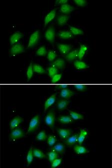 PP2Ac / PPP2CA Antibody - Immunofluorescence analysis of HeLa cells.