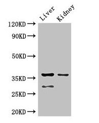 PP2Ac / PPP2CA Antibody - Western Blot Positive WB detected in: Mouse liver tissue, Mouse kidney tissue All lanes: PPP2CA antibody at 2.5µg/ml Secondary Goat polyclonal to rabbit IgG at 1/50000 dilution Predicted band size: 36, 30 kDa Observed band size: 36, 30 kDa