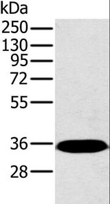 PP2Ac / PPP2CA Antibody - Western blot analysis of Mouse brain tissue, using PPP2CA Polyclonal Antibody at dilution of 1:450.