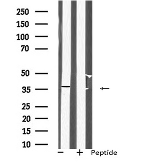 PP2Ac / PPP2CA Antibody - Western blot analysis of PPP2CA using Jurkat whole cells lysates
