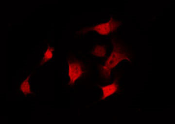PP2Ac / PPP2CA Antibody - Staining A549 cells by IF/ICC. The samples were fixed with PFA and permeabilized in 0.1% Triton X-100, then blocked in 10% serum for 45 min at 25°C. The primary antibody was diluted at 1:200 and incubated with the sample for 1 hour at 37°C. An Alexa Fluor 594 conjugated goat anti-rabbit IgG (H+L) Ab, diluted at 1/600, was used as the secondary antibody.