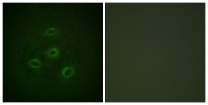 PP2Ac / PPP2CA Antibody - Peptide - + Immunofluorescence analysis of HepG2 cells, using PP2A-a (Ab-307) antibody.