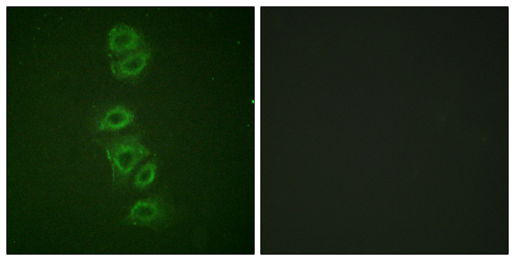 PP2Ac / PPP2CA Antibody - Immunofluorescence analysis of A549 cells, using PP2A-alpha (Phospho-Tyr307) Antibody. The picture on the right is blocked with the phospho peptide.