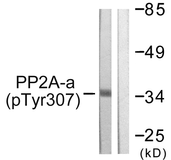 PP2Ac / PPP2CA Antibody - Western blot analysis of lysates from A549 cells, using PP2A-alpha (Phospho-Tyr307) Antibody. The lane on the right is blocked with the phospho peptide.