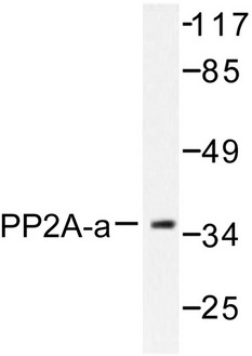 PP2Ac / PPP2CA Antibody - Western blot of PP2A- (T301) pAb in extracts from A549 cells.