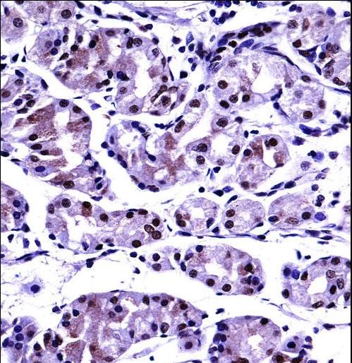PP2CB / PPP2CB Antibody - PPP2CB Antibody immunohistochemistry of formalin-fixed and paraffin-embedded human stomach tissue followed by peroxidase-conjugated secondary antibody and DAB staining.