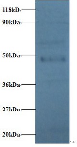 PP2CB / PPP2CB Antibody - Western blot of Serine/threonine-protein phosphatase 2A catalytic subunit beta isoform Antibody at 2 ug/ml + EC109 whole cell lysate at 20 ug. Secondary: Goat polyclonal to Rabbit IgG at 1:15000 dilution. Predicted band size: 34 kDa. Observed band size: 45 kDa.  This image was taken for the unconjugated form of this product. Other forms have not been tested.