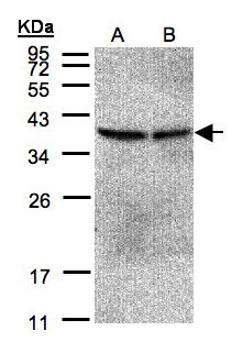 PP2CB / PPP2CB Antibody - Sample(30 g of whole cell lysate). A:293T. B: A431. 12% SDS PAGE. PPP2CB antibody diluted at 1:500.