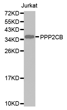 PP2CB / PPP2CB Antibody - Western blot analysis of extracts of Jurkat cell lines, using PPP2CB antibody.
