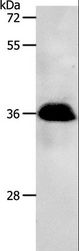 PP2CB / PPP2CB Antibody - Western blot analysis of Jurkat cell, using PPP2CB Polyclonal Antibody at dilution of 1:1200.