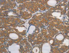 PP2CB / PPP2CB Antibody - Immunohistochemistry of paraffin-embedded Human tonsil using PPP2CB Polyclonal Antibody at dilution of 1:80.