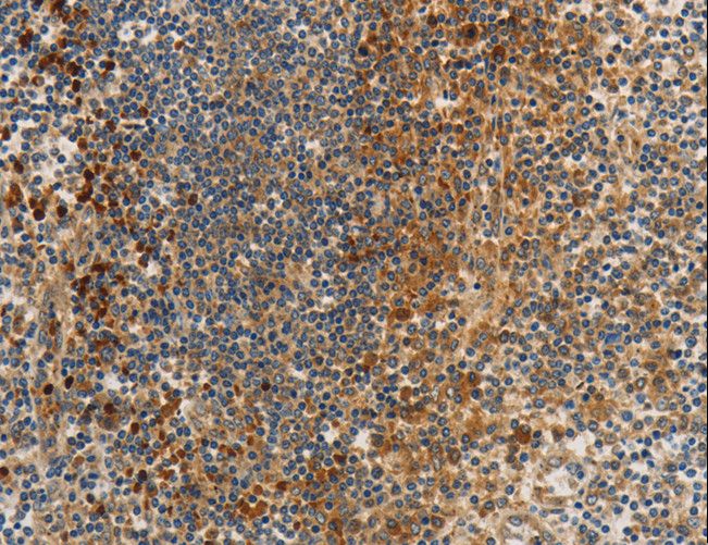 PP2CB / PPP2CB Antibody - Immunohistochemistry of paraffin-embedded Human tonsil using PPP2CB Polyclonal Antibody at dilution of 1:80.