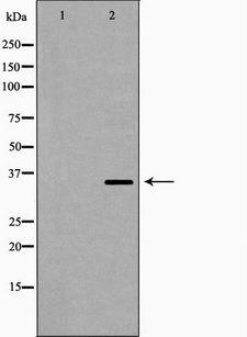 PP2CB / PPP2CB Antibody - Western blot analysis of extracts of Jurkat cells using PPP2CB antibody. The lane on the left is treated with the antigen-specific peptide.