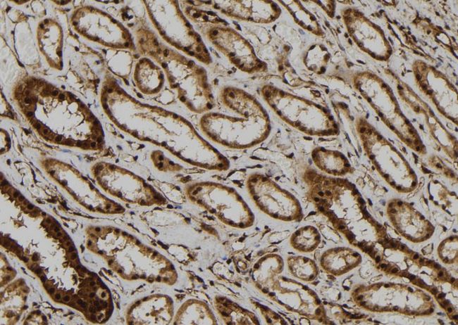 PP2CB / PPP2CB Antibody - 1:100 staining human kidney tissue by IHC-P. The sample was formaldehyde fixed and a heat mediated antigen retrieval step in citrate buffer was performed. The sample was then blocked and incubated with the antibody for 1.5 hours at 22°C. An HRP conjugated goat anti-rabbit antibody was used as the secondary.