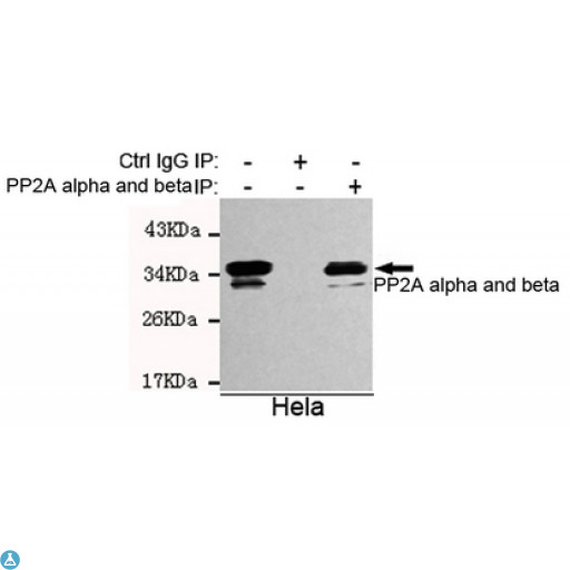PP2CB / PPP2CB Antibody - Immunoprecipitation analysis of Hela cell lysates using PP2A alpha and beta mouse mAb.