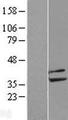 PP2CB / PPP2CB Protein - Western validation with an anti-DDK antibody * L: Control HEK293 lysate R: Over-expression lysate