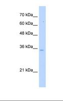 PPA1 Antibody - HepG2 cell lysate. Antibody concentration: 5.0 ug/ml. Gel concentration: 12%.  This image was taken for the unconjugated form of this product. Other forms have not been tested.