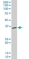 PPA1 Antibody - PPA1 monoclonal antibody (M01), clone 3B2. Western Blot analysis of PPA1 expression in PC-12.