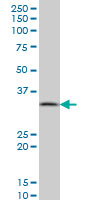 PPA1 Antibody - PPA1 monoclonal antibody (M01), clone 3B2 Western Blot analysis of PPA1 expression in A-431.