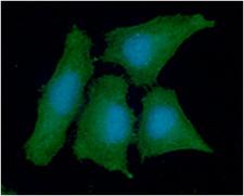 PPA1 Antibody - ICC/IF analysis of PPA1 in HeLa cells line, stained with DAPI (Blue) for nucleus staining and monoclonal anti-human PPA1 antibody (1:100) with goat anti-mouse IgG-Alexa fluor 488 conjugate (Green).