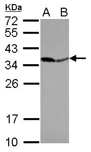 PPA1 Antibody - Sample (30 ug of whole cell lysate) A: IMR32 B: U87-MG 12% SDS PAGE PPA1 antibody diluted at 1:10000