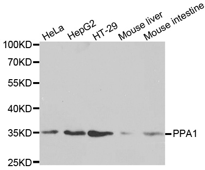 PPA1 Antibody - Western blot analysis of extracts of various cell lines.