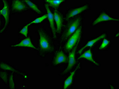 PPA1 Antibody - Immunofluorescence staining of Hela cells with PPA1 Antibody at 1:66, counter-stained with DAPI. The cells were fixed in 4% formaldehyde, permeabilized using 0.2% Triton X-100 and blocked in 10% normal Goat Serum. The cells were then incubated with the antibody overnight at 4°C. The secondary antibody was Alexa Fluor 488-congugated AffiniPure Goat Anti-Rabbit IgG(H+L).