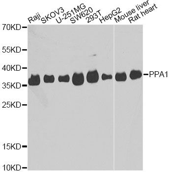PPA1 Antibody - Western blot analysis of extracts of various cell lines, using PPA1 antibody at 1:1000 dilution. The secondary antibody used was an HRP Goat Anti-Rabbit IgG (H+L) at 1:10000 dilution. Lysates were loaded 25ug per lane and 3% nonfat dry milk in TBST was used for blocking. An ECL Kit was used for detection and the exposure time was 5s.
