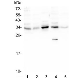 PPA1 Antibody - Western blot testing of human 1) PC-3, 2) Caco-2, 3) HEK293, 4) K562 and 5) U-2 OS lysate with PPA1 antibody at 0.5ug/ml. Predicted molecular weight: ~33 kDa.