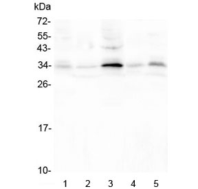 PPA1 Antibody - Western blot testing of 1) rat thymus, 2) rat kidney, 3) rat testis, 4) mouse kidney and 5) mouse testis lysate with PPA1 antibody at 0.5ug/ml. Predicted molecular weight: ~33 kDa.