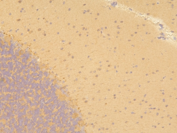 PPA1 Antibody - IHC staining of FFPE rat brain with PPA1 antibody at 1ug/ml. HIER: boil tissue sections in pH6, 10mM citrate buffer, for 10-20 min and allow to cool before testing.