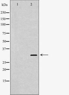 PPA1 Antibody - Western blot analysis of extracts of human heart tissue using PPA1 antibody. The lane on the left is treated with the antigen-specific peptide.