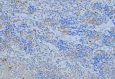 PPA1 Antibody - 1:100 staining human lymph node tissue by IHC-P. The sample was formaldehyde fixed and a heat mediated antigen retrieval step in citrate buffer was performed. The sample was then blocked and incubated with the antibody for 1.5 hours at 22°C. An HRP conjugated goat anti-rabbit antibody was used as the secondary.
