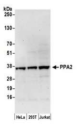 PPA2 Antibody - Detection of human PPA2 by western blot. Samples: Whole cell lysate (50 µg) from HeLa, HEK293T, and Jurkat cells prepared using NETN lysis buffer. Antibody: Affinity purified rabbit anti-PPA2 antibody used for WB at 0.1 µg/ml. Detection: Chemiluminescence with an exposure time of 30 seconds.