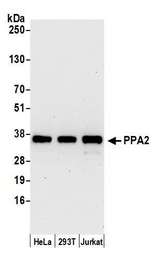 PPA2 Antibody - Detection of human PPA2 by western blot. Samples: Whole cell lysate (15 µg) from HeLa, HEK293T, and Jurkat cells prepared using NETN lysis buffer. Antibody: Affinity purified rabbit anti-PPA2 antibody used for WB at 0.1 µg/ml. Detection: Chemiluminescence with an exposure time of 30 seconds.