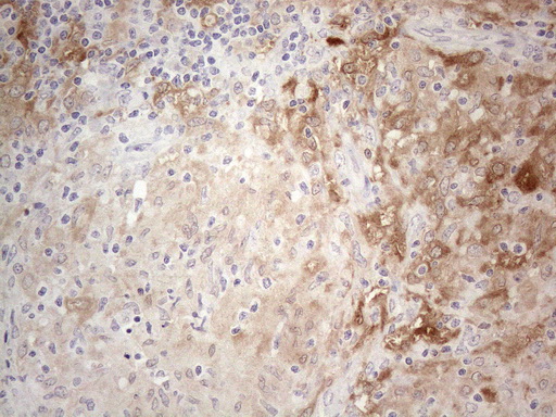 PPA2 Antibody - Immunohistochemical staining of paraffin-embedded Human lymph node tissue within the normal limits using anti-PPA2 mouse monoclonal antibody. (Heat-induced epitope retrieval by 1mM EDTA in 10mM Tris buffer. (pH8.5) at 120°C for 3 min. (1:150)