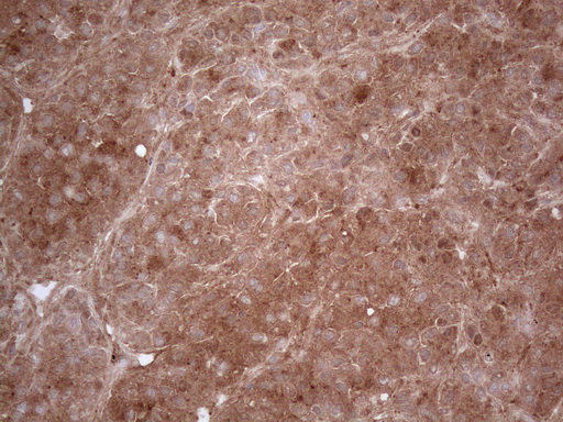 PPA2 Antibody - Immunohistochemical staining of paraffin-embedded Human liver tissue within the normal limits using anti-PPA2 mouse monoclonal antibody. (Heat-induced epitope retrieval by 1mM EDTA in 10mM Tris buffer. (pH8.5) at 120°C for 3 min. (1:150)