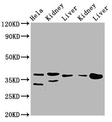 PPA2 Antibody - Western Blot Positive WB detected in: Hela whole cell lysate, Rat kidney tissue, Rat liver tissue, Mouse kidney tissue, Mouse liver tissue All Lanes: PPA2 antibody at 3.1µg/ml Secondary Goat polyclonal to rabbit IgG at 1/50000 dilution Predicted band size: 38, 40, 35, 19, 26 KDa Observed band size: 38 KDa